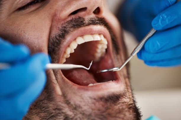 Best Emergency Broken Tooth Repair in Bethel Rk, PA